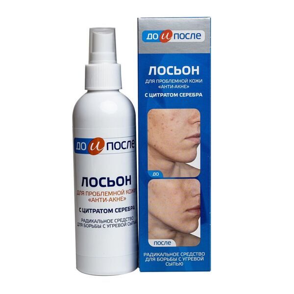 ДО и После Анти-Акне лосьон для проблемной кожи 200мл