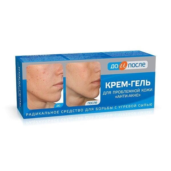 ДО и После Анти-Акне крем-гель для проблемной кожи 50мл